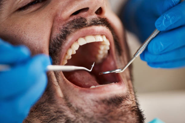  Beach, ND Emergency Dentist Pros